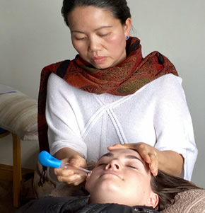 An example of modern cupping therapy in action