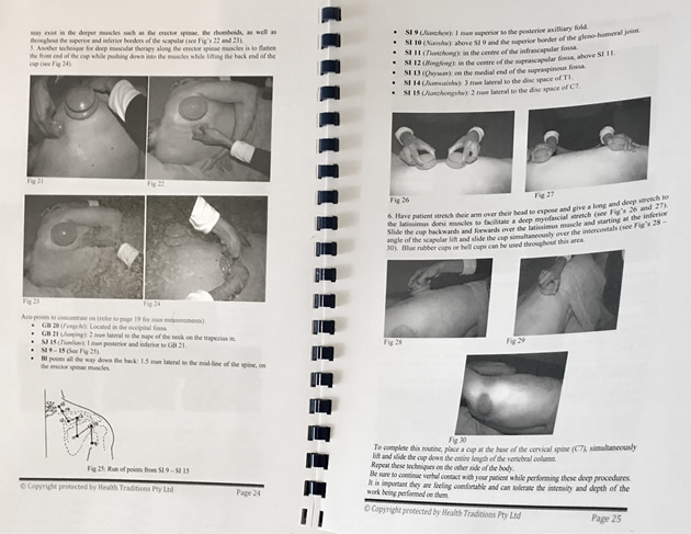 Modern Cupping Therapy workbook