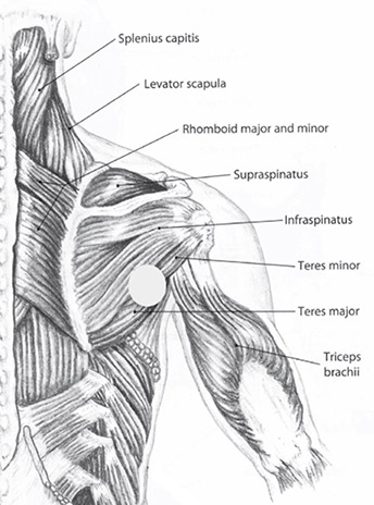 Muscles of the upper back (Biel, 2010: p.61): The area of deficiency is indicated as a white circle.