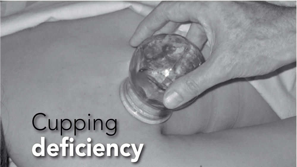 Cupping Deficiency