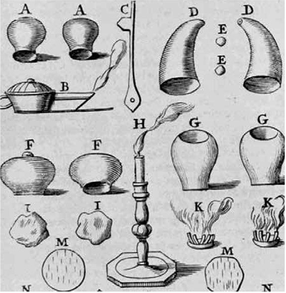 Detail of cupping instruments: A. cups made of horn; B. lamp for exhausting air; C. fleam [a sharp lancet or blade] for making scarifications; D. horns with holes at the tip for mouth suction; E. balls of wax to close the holes in the horn cups; F. G. glass cups; H. candle to light the tow or the small candles; I. tow; K. small candles on a card which is placed over the scarifications and lit in order to exhaust the cup; M. scarifications made for wet cupping.