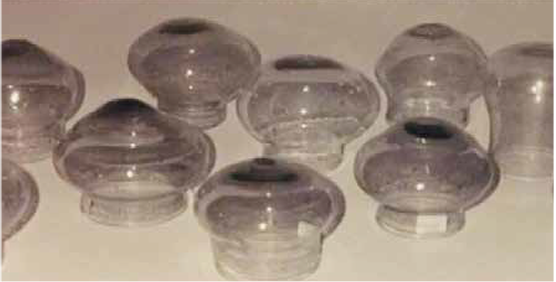 Fine glass cups from Pompeii on display at the Department for the History of Medicine, University of Rome (photo Bentley, 1998).