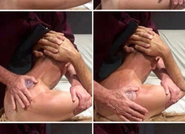Silicone cupping treatment